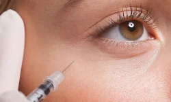 تزریق-فیلر-زیر-چشم تزریق-فیلر-زیر-چشم